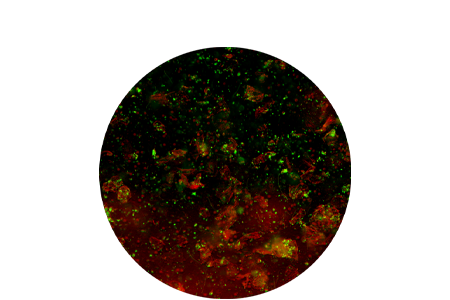 Ear cytology cells.