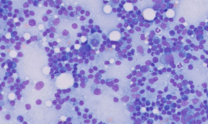 Lymph node cells.