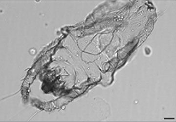 Urine sediment dust mite on a slide