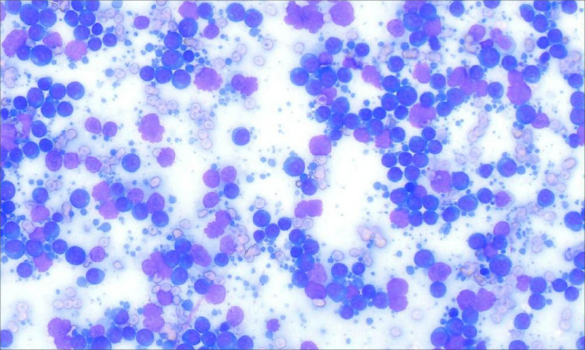 Digital cytology image (large cell lymphoma) accompanying the pathologist’s report in VetConnect PLUS.