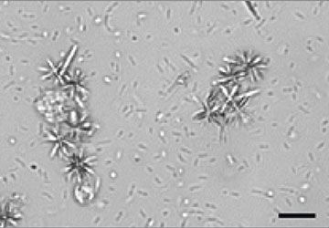 Types of crystals sales in dog urine