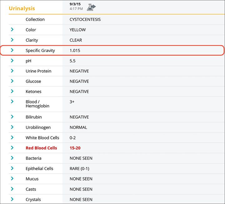 Urinalysis report screenshot for Zeke case study