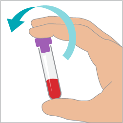 Procyte Dx blood collection step 4.