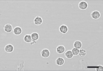Urine sediment white blood cells on a slide