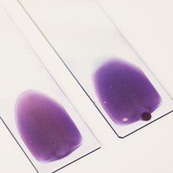Two stained slides for scanning with the IDEXX Digital Cytology Instrument