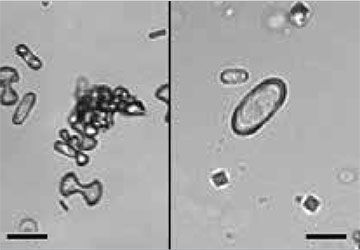 Understanding SediVue urinalysis results IDEXX US