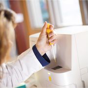 Technician dispensing the sample into the SediVue Dx urine sediment analyzer.