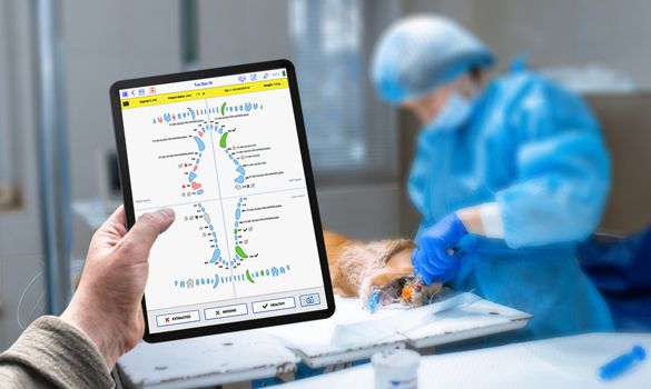 SmartFlow dental charts being used on an iPad