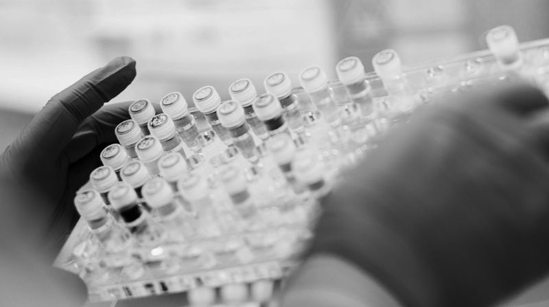 Rack of blood sample tubes, black and white.