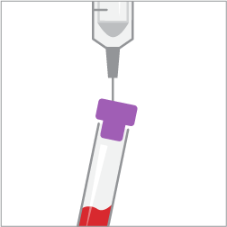 Procyte Dx blood collection step 3.