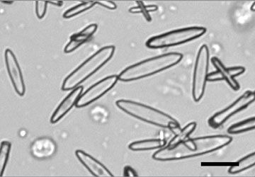 Urine sediment calcium oxalate monohydrate picket fence crystals on a slide