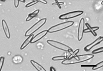 Canine calcium oxalate hot sale crystals