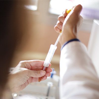 Technician pipetting 4-5 drops of urine from the SediVue pipette