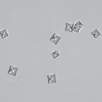 Calcium oxalate dihydrate crystals on a slide
