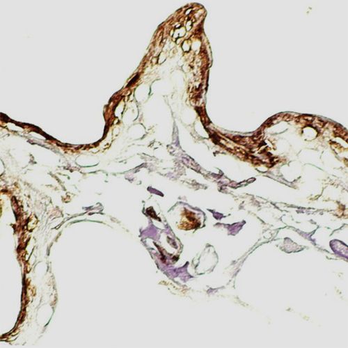Dipylidium caninum (flea tapeworm) under a microscope.