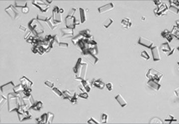 Urine sediment small struvite crystals on a slide