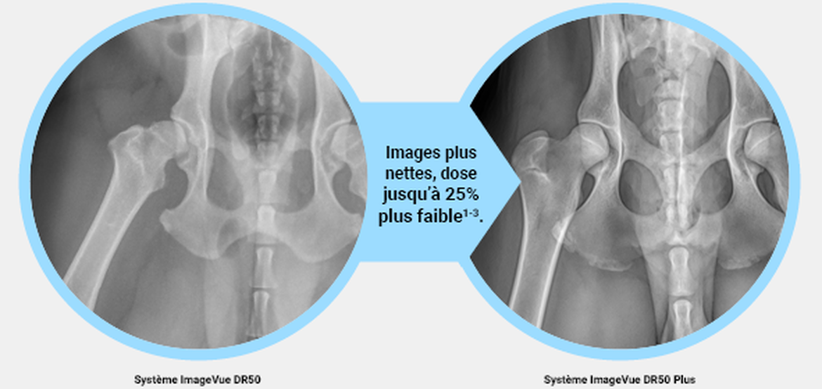Le système ImageVue DR50 Plus a des images plus détaillées avec un rayonnement jusqu’à 25 % inférieur à celui du système précédent.