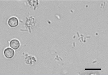 Urine sediment bacteria rods with white blood cells on a slide