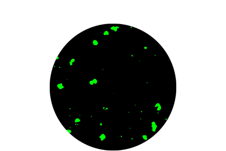 Ear cytology cells.