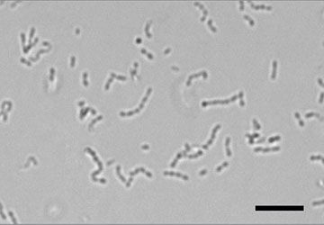 Urine sediment bacteria cocci chains on a slide