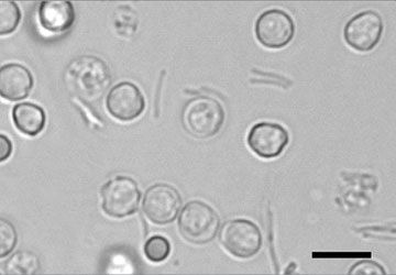 Urine sediment bacteria rods with white and red blood cells on a slide