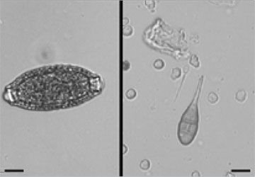Urine sediment pearsonema spp capillaria spp ova and macrocanidia on a slide