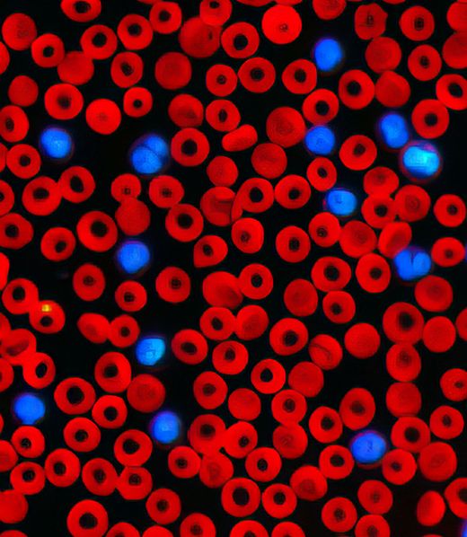 A microscopic view of blood cells.