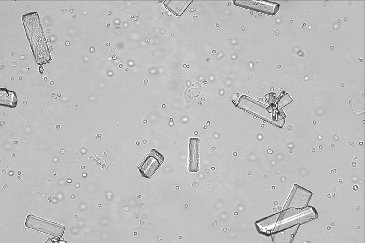 Image of cells, casts, and crystals from the SediVue Dx Urine Sediment Analyzer