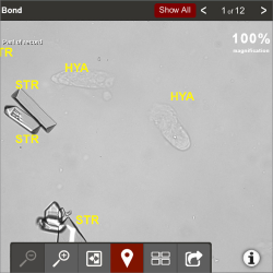 SediVue Dx analyzer image of cells, casts, and crystals.