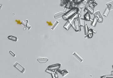 Struvite crystals in dog urine sales