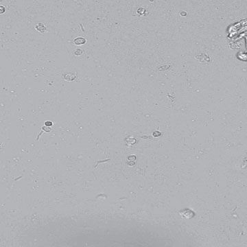 A microscope slide of bacteria found in urine